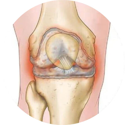 Knee brace