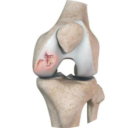 Knee brace